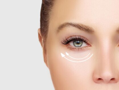 Μαύροι κύκλοι στα μάτια